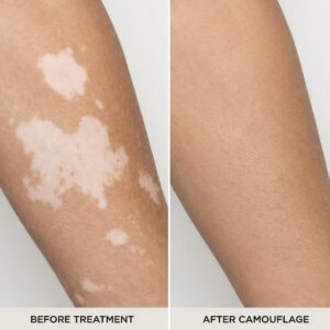 Pigmenti Camuflaj / corectii
